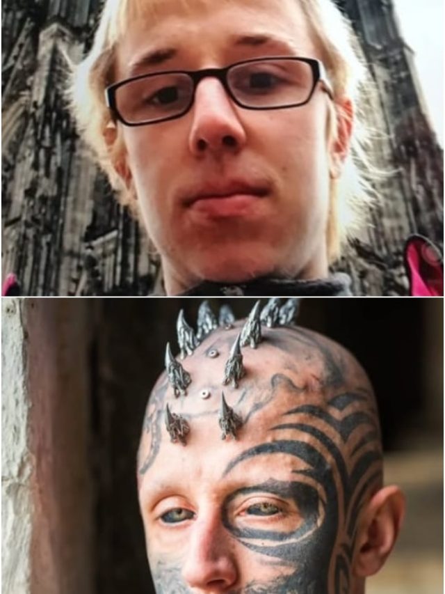 मगरमच्छ जैसा दिखना चाहता था, तो सिर में लगवाया सिलिकॉन, अब दिखता है ऐसा