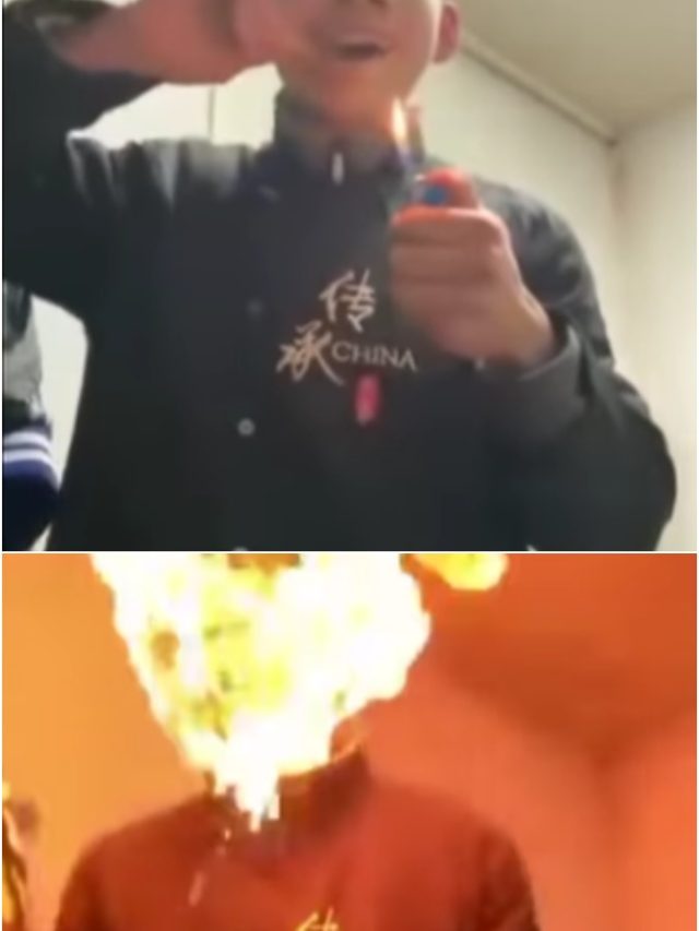 लाइटर से कर रहा था कलाकारी, मुंह में लग गई आग... Video वायरल
