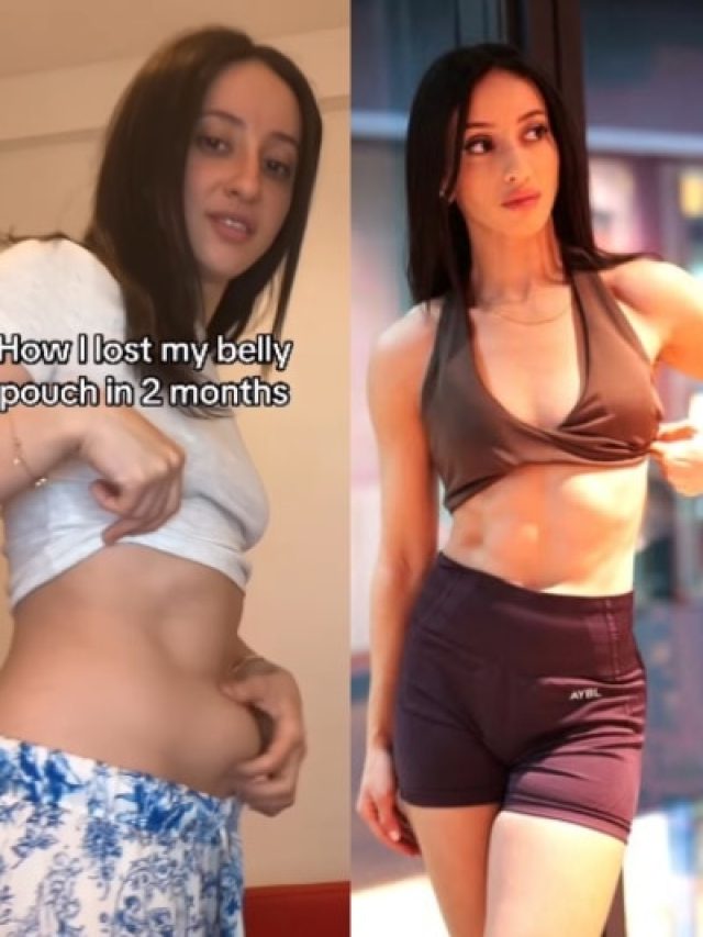 2 महीने में पिचक गया महिला का गुब्बारे जैसा फूला पेट, इन 5 चीजों को किया फॉलो, VIdeo