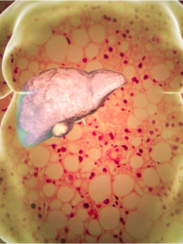 लिवर को हेल्दी रखने के लिए क्या खाना चाहिए, ये 5 चीजें है जरूरी