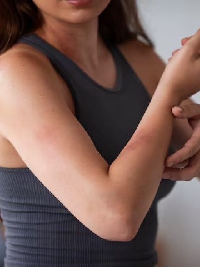 মশার উৎপাত বাড়ার আগেই তাড়িয়ে দিন, শুধু এই জিনিসটি আনুন