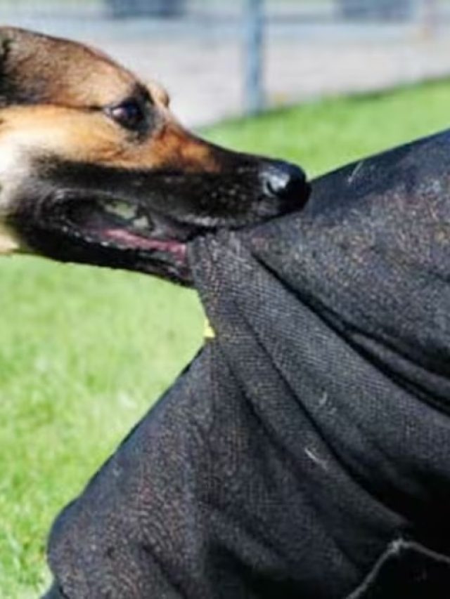 রাস্তায় বেরিয়ে হঠাৎ কুকুর কামড়ালে, প্রথমেই যা করবেন, মাথায় রাখুন