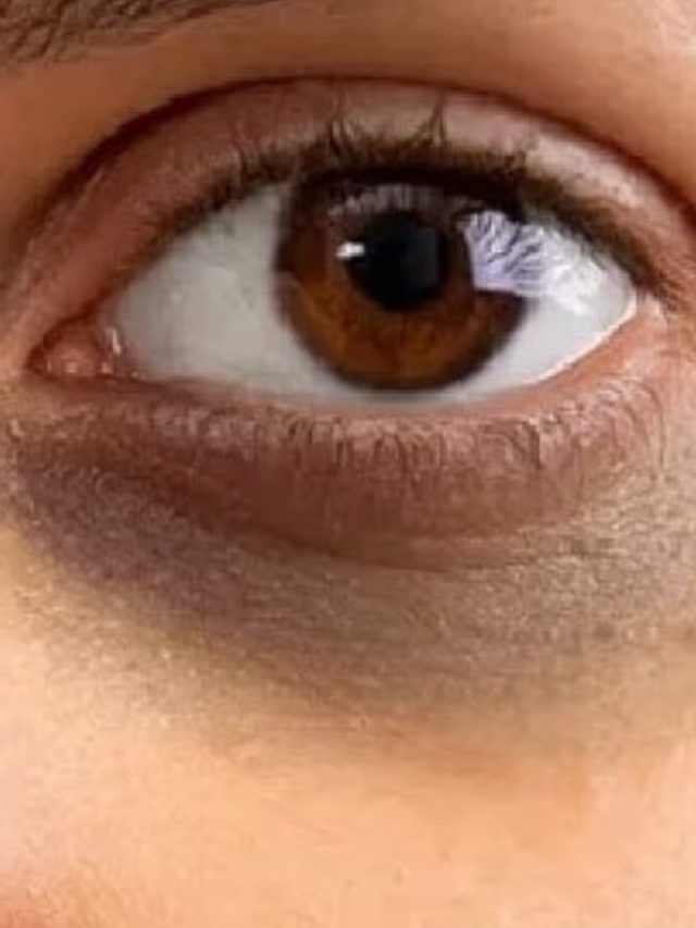 চোখের উপর ঝুলিয়ে দিন এই ব্যাগ, কালো দাগ নিমেষে সাফ  হবে