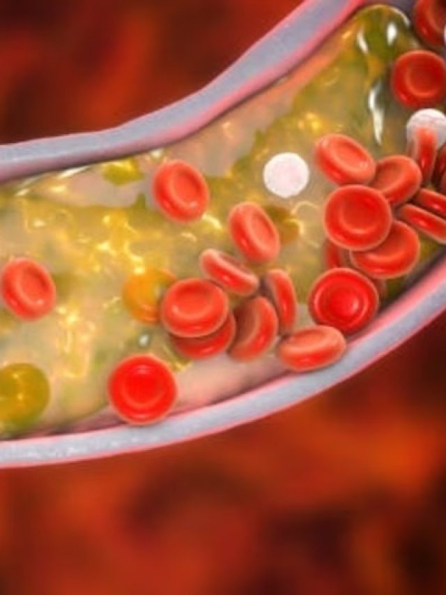 এই সবজি কামড়ে খেলেই পাঁই পাঁই করে পালাবে কোলেস্টেরল