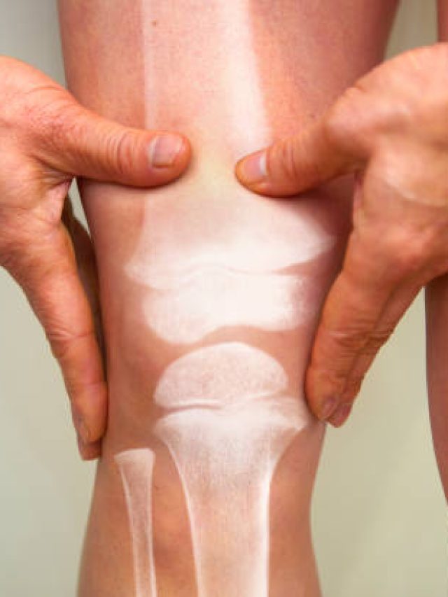 हड्डियों को मजबूत करना है तो रोज खाएं ये ड्राई फ्रूट, जवान रहने में भी करेगा मदद