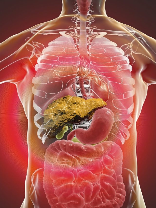 ফ্যাটি লিভারকে সিরোসিসে পরিণত কর এই ৫ খাবার, পচতে শুরু করে যকৃৎ