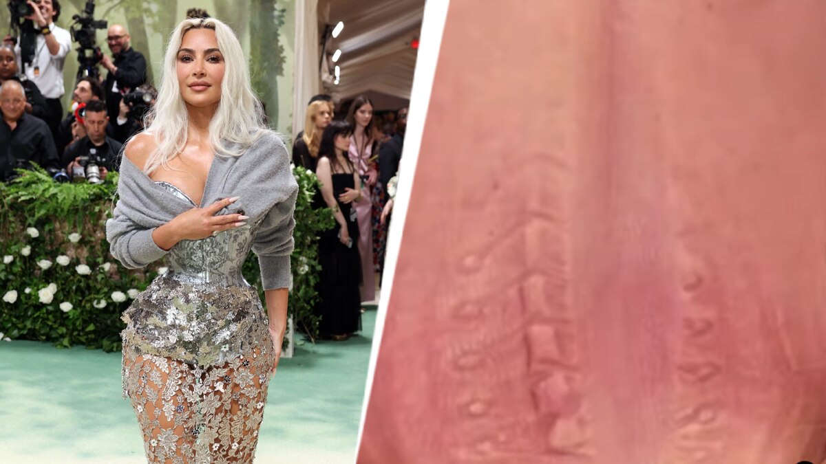 अरबपति हसीना ने पहनी इतनी टाइट ड्रेस, छिली पीठ, सांस लेना मुश्किल, बोलीं- मर जाऊंगी