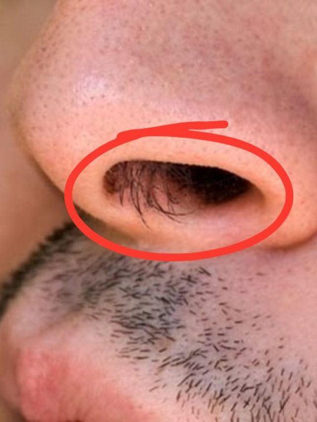 নাকে বড় বড় চুল গজানো কীসের ইঙ্গিত? জানেন না বেশিরভাগ মানুষ