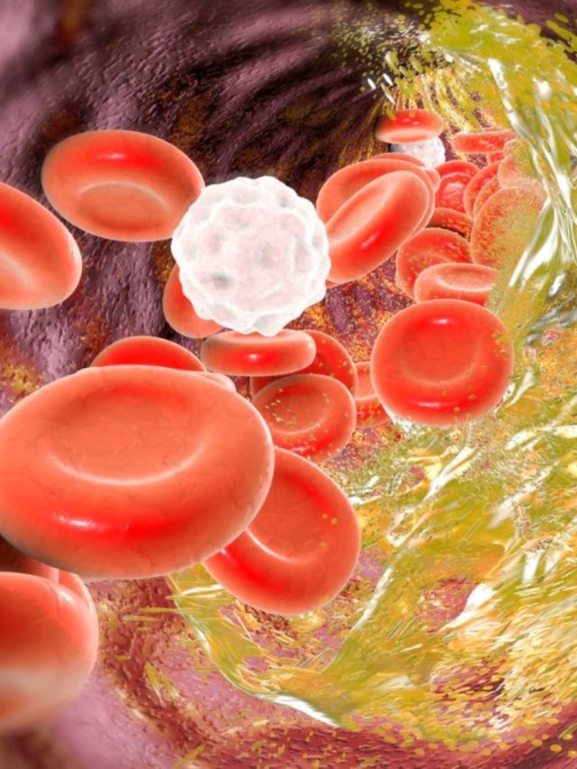 কোলেস্টেরল ভাগায়  ১০ টাকার এই জিনিস, রোজ খেলে দারুণ উপকার