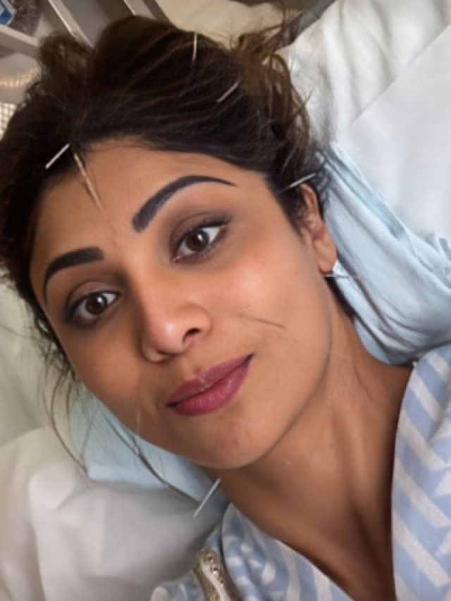 शिल्पा के चेहरे पर घुसी सुइयां, देख डर गए थे लोग, इस बीमारी से छुटकारा दिलाती है ये थेरेपी