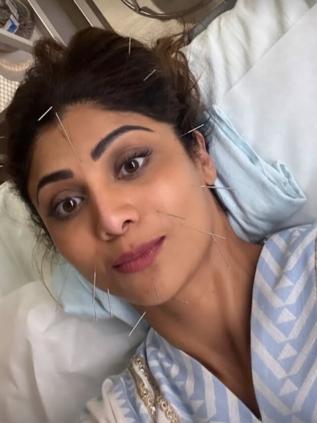 खूबसूरत दिखने के ल‍िए श‍िल्पा ने चेहरे पर चुभाईं सुई, तस्वीर देखकर उड़ेंगे होश