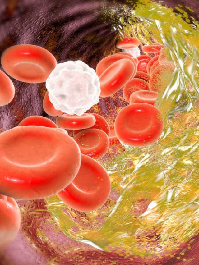 दोगुनी तेजी से कोलेस्ट्रॉल बढ़ाते हैं ये 6 फूड्स, बढ़ सकता है 'हार्ट अटैक' का जोखिम