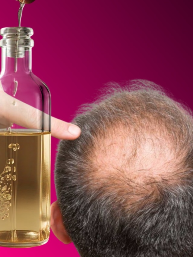 নারকেল তেলে দিন এই ক্যাপসুল, ন্যাড়া মাথায় গজাবে ঘন চুল