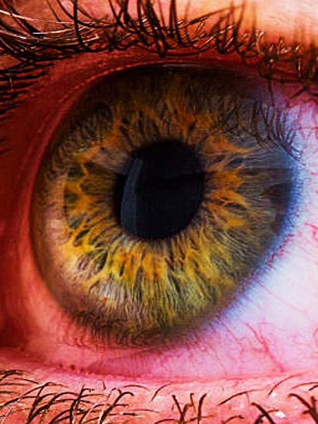 आंखों में दिखें अगर ऐसे संकेत तो तुरंत कराएं शुगर टेस्ट, देरी पड़ेगी भारी