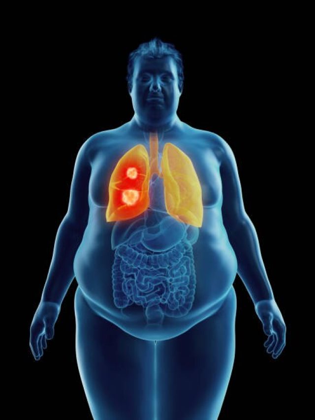 क्या होगा अगर डाइट से पूरी तरह हटा देंगे प्रोटीन, हल्के में लेना पड़ सकता है भारी