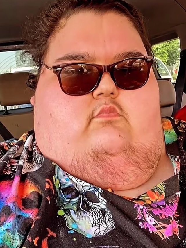 ज्यादा खाना खाने से 24 साल के युवक का फटा पेट! हुई मौत