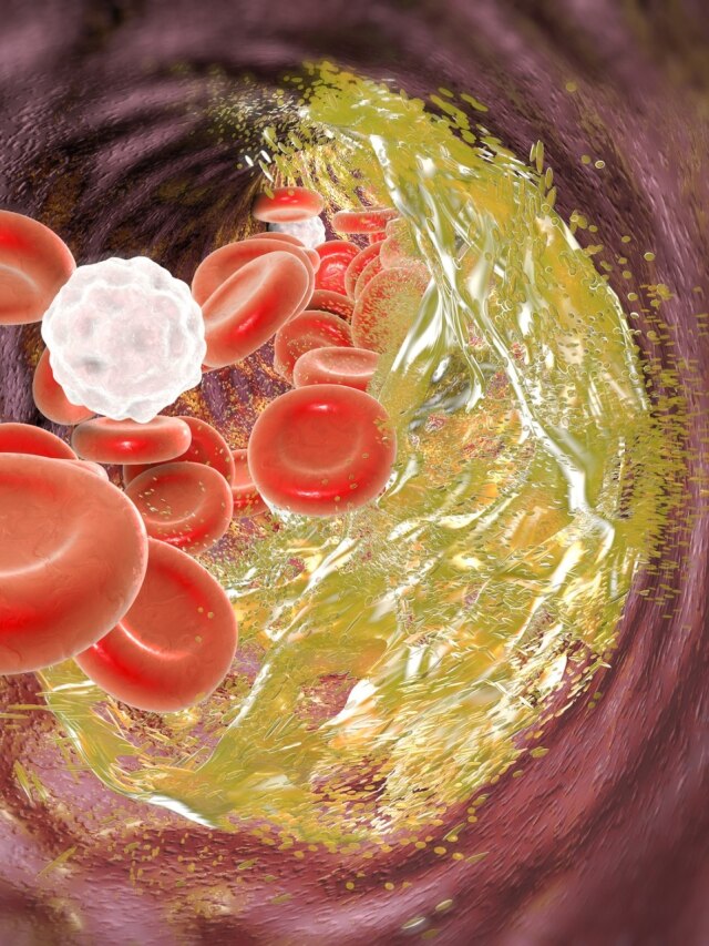 गंदे कोलेस्ट्रॉल को निकालना चाहते हैं शरीर से बाहर? इन चीजों से कर लें दोस्ती