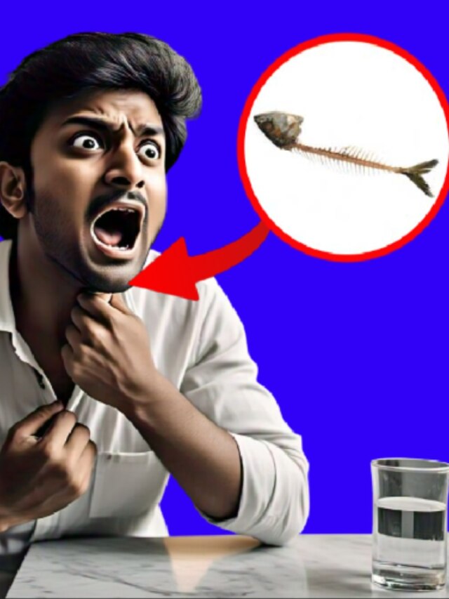 গলায় মাছের কাঁটা আটকে? এই ট্রিকসে এক সেকেন্ডে বেরোবে