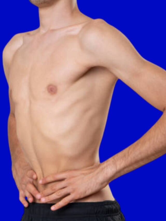 রোগা থেকে ফিট হতে চান? ডায়েটে রাখুন এই ৫ খাবার