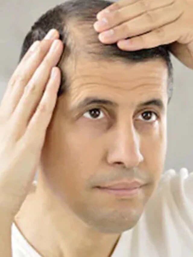 টাক মাথাও ভরবে কালো চুলে, রান্নাঘরের এই সবজিতেই হবে কাজ