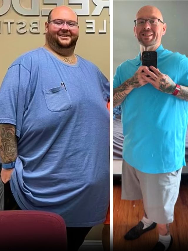 288 किलो के शख्स ने घटाया 159 Kg वजन...खाते थे सिर्फ ये चीजें, PHOTOS