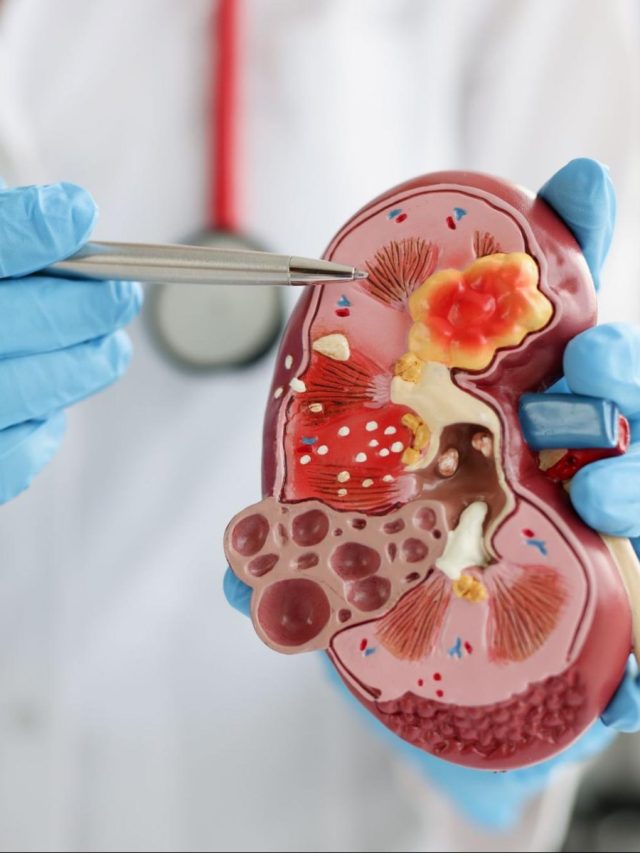 ওষুধ-অস্ত্রোপচার নয়, এই পাতাই গলিয়ে বের করে দেবে কিডনি স্টোন