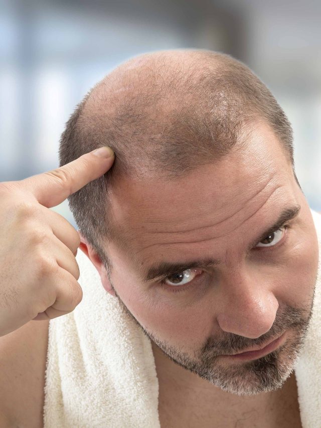 गंजे सिर पर फिर आ सकते हैं बाल, 7 देसी चीजों से मिलेगी मदद