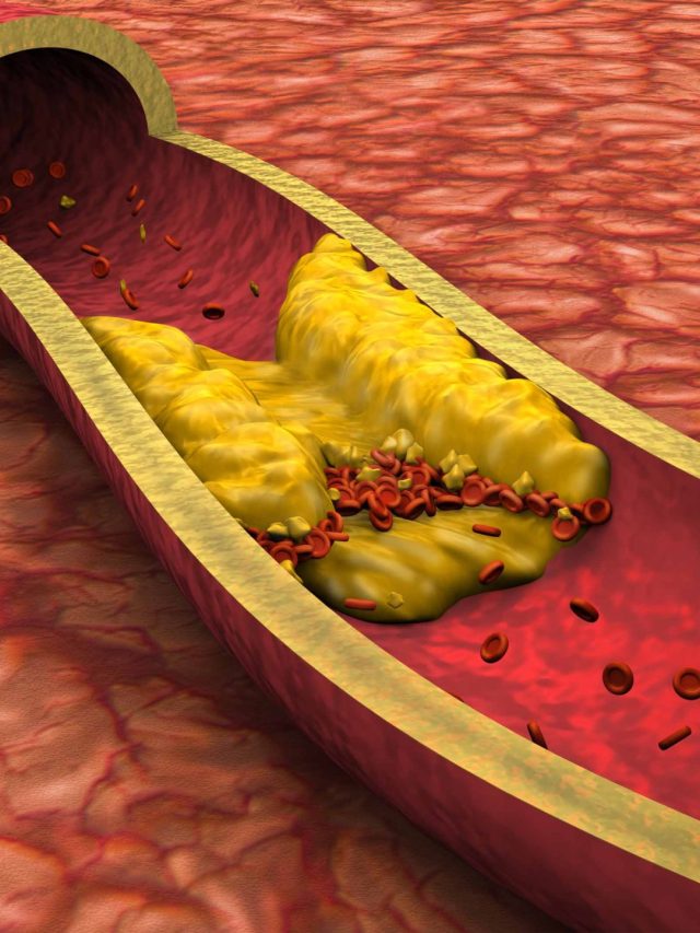 गंदे कोलेस्ट्रॉल को निचोड़कर बाहर फेंक देती हैं ये चीजें, बस इस तरह रोज करें सेवन