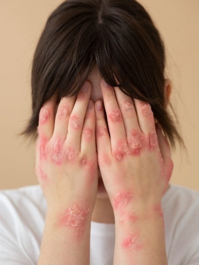 दाद, खाज..खुजली से कैसे पाएं निजात? अपनाएं आयुर्वेदिक डॉक्टर के ये टिप्स