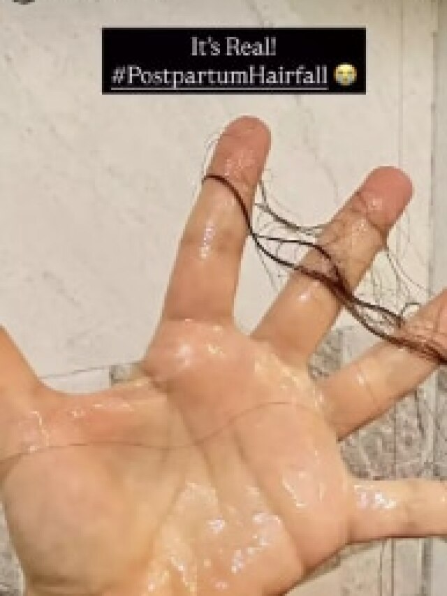 4 महीने के हुए जुड़वां बच्चे, एक्ट्रेस को हुई बाल झड़ने की दिक्कत, बोली- पोस्टपार्टम...