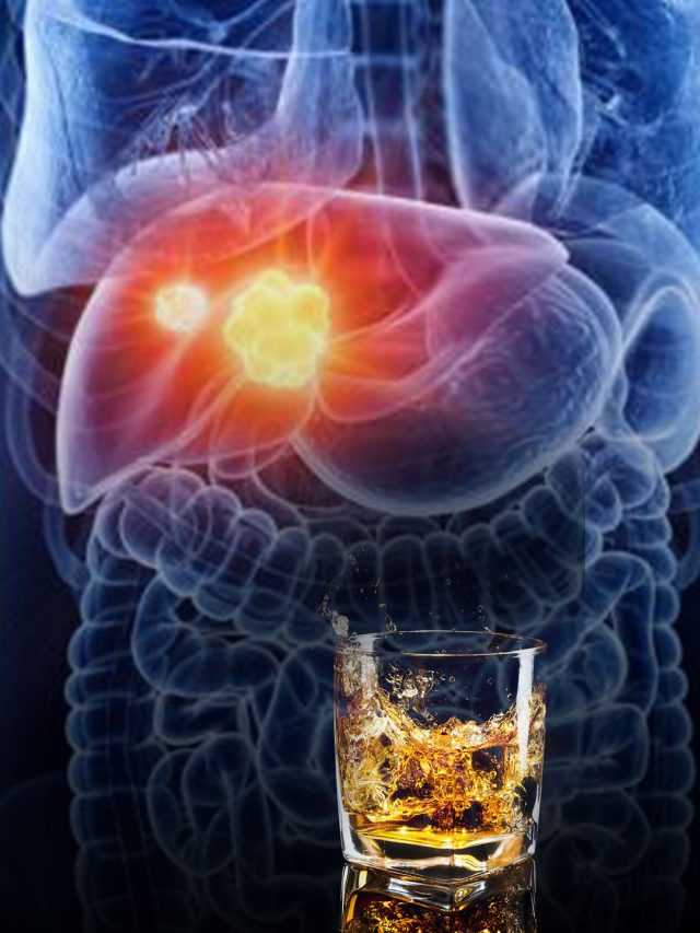 40 ग्राम शराब लिवर कर सकती है खराब, अपोलो के डॉक्टर ने बताया किसे ज्यादा रिस्क