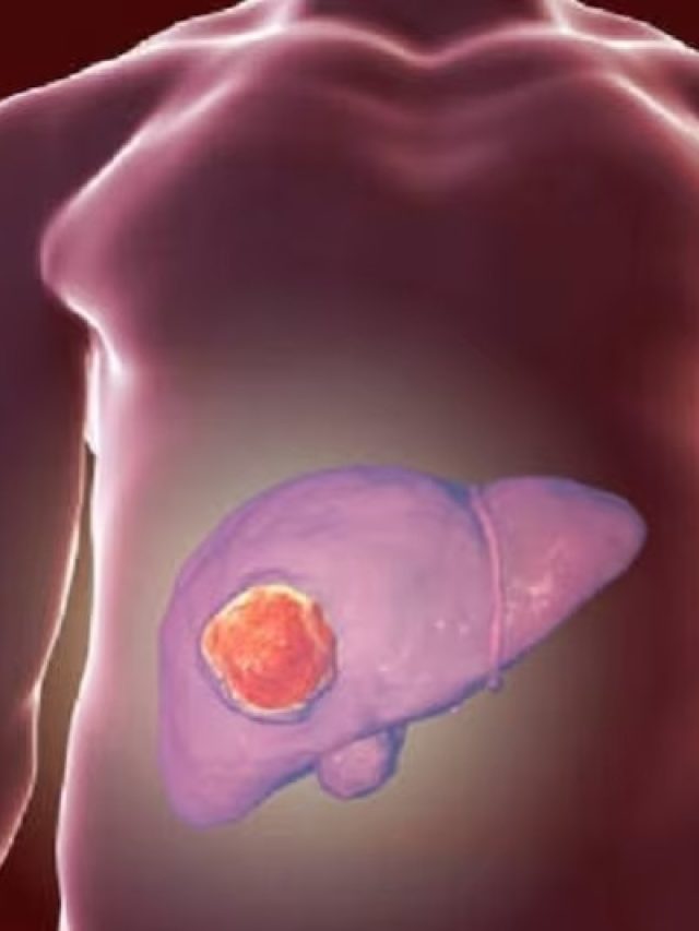 লিভারকে পচিয়ে দেয় এই ৫ খাবার, সতর্ক না হলে সর্বনাশ