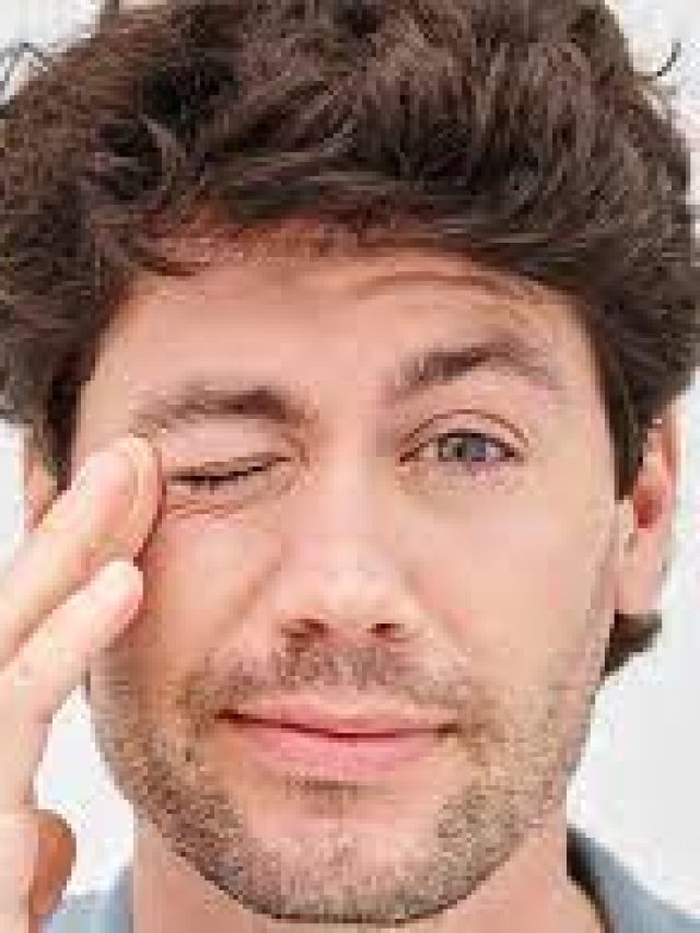 আর্থ্রাইটিস চোখেও হয়! জেনে নিন উপসর্গ ও চিকিৎসা