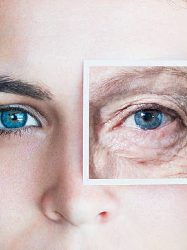 बुढ़ापा भागेगा कोसों दूर और झुर्रियां हो जाएंगी कम, अगर बैलेंस डाइट के साथ खाएंगे ये चीजें