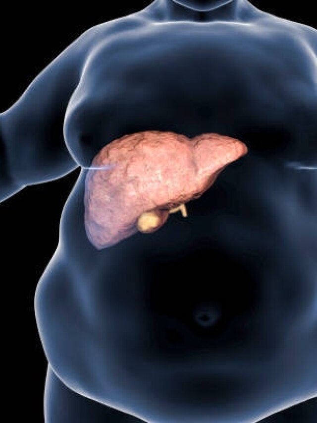 Fatty Liver का संकेत हो सकता है ये लक्षण, जोखिम बढ़ने से पहले खुद ही पहचान लें