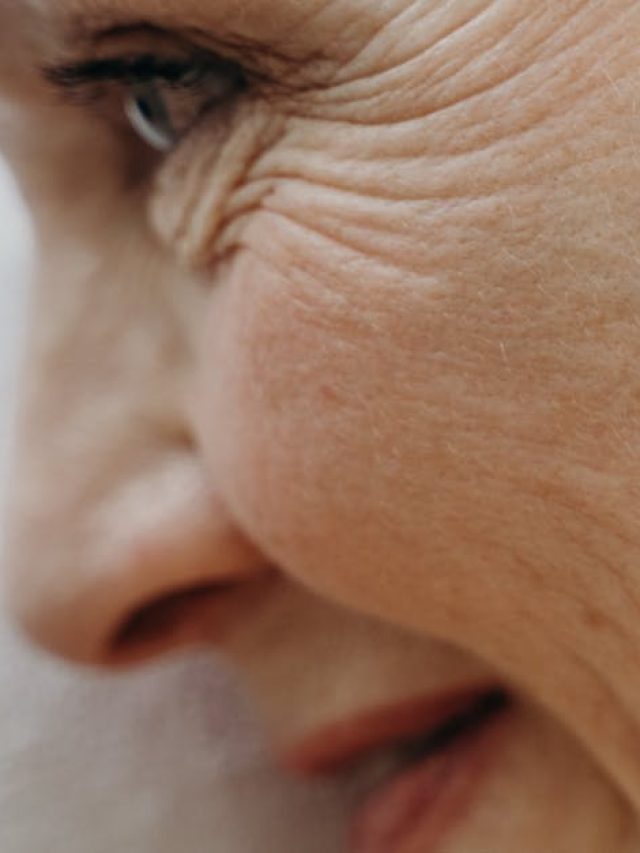 झुर्रियों से झूल गई है आपकी पूरी स्किन? इस चीज का रस आएगा आपके काम