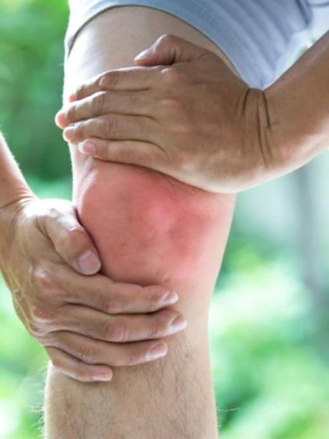 यूरिक एसिड के दुश्मन हैं ये 4 फूड्स, खाने से जल्द मिलेगा फायदा