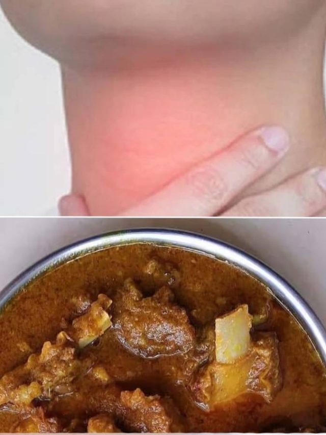 গলায় মাংসের হাড় আটকালে কী করবেন? রইল টিপস