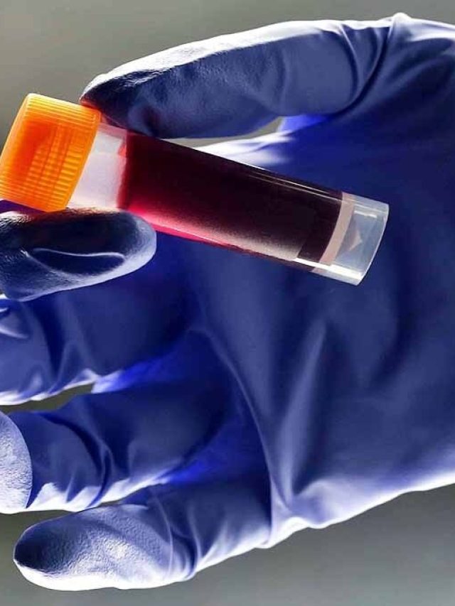 A ব্লাড গ্রুপের  ছেলেমেয়েদের স্বভাব কেমন, ভবিষ্যতে কী থাকে