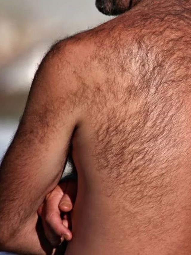 পিঠে চুল গজালে কিসের ইঙ্গিত,  জানা উচিত