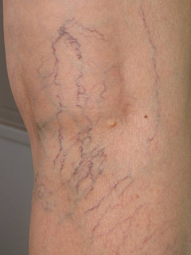 রক্তের রং লাল, তাহলে শিরা সবুজ বা নীল দেখায় কেন?