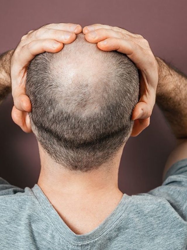 বিনা খরচে টেকো মাথায় গজাবে কচি চুল, নাপিতের জব্বর টিপস