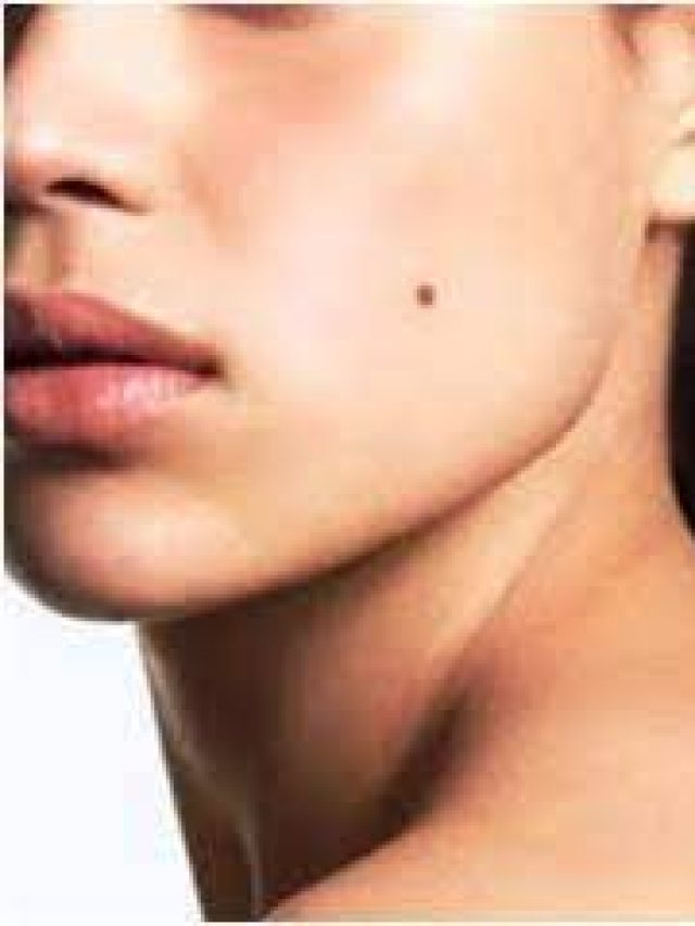 শরীরে জোড়া লাল তিল, কীসের ইঙ্গিত জানেন?