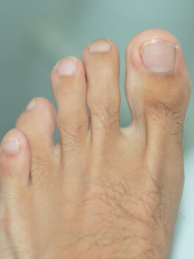 মানুষটার চরিত্র ও স্বভাব কেমন? পায়ের আঙুল দেখেই বুঝে নিন