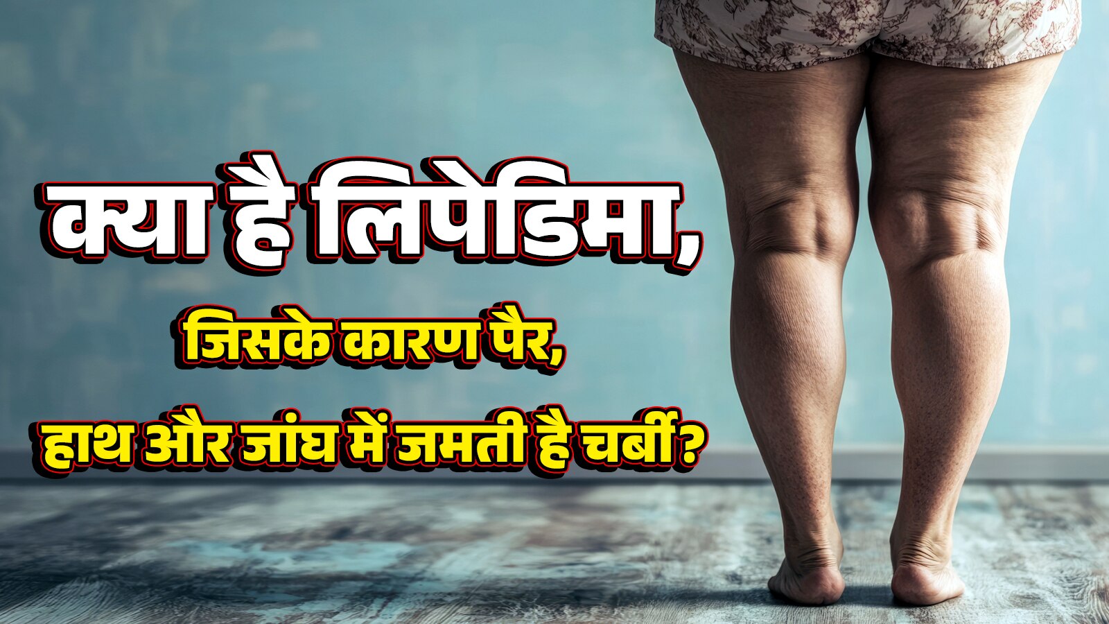 पैर-जांघ की लटकती चर्बी लिपेडिमा का हो सकता है संकेत! डॉक्टर ने बताया पहचानने का तरीका