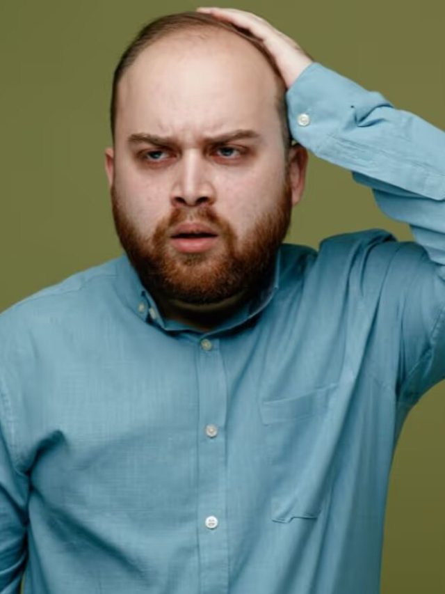 গড়ের মাঠের মতো মাথাতেও চুল গজাবে এই মাটি লাগালে! টাকের জন্য টিপস