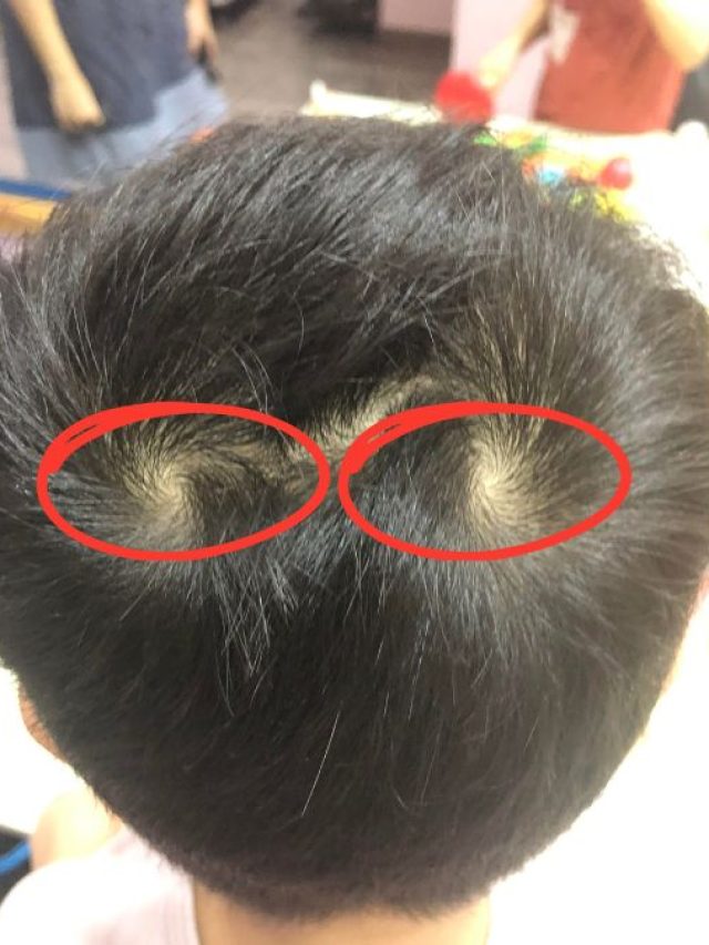 মাথায় জোড়া ঘূর্ণি থাকা কীসের ইঙ্গিত? জানুন শাস্ত্র কী বলছে