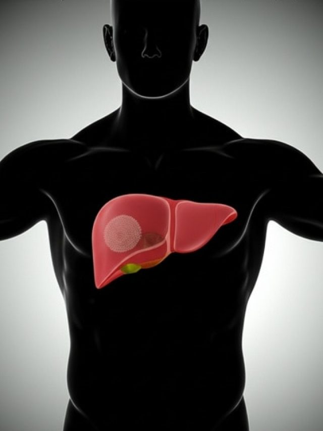 Liver डैमेज से बचाएंगे ये 5 फल, लिवर डॉक्टर ने गिनाए नाम