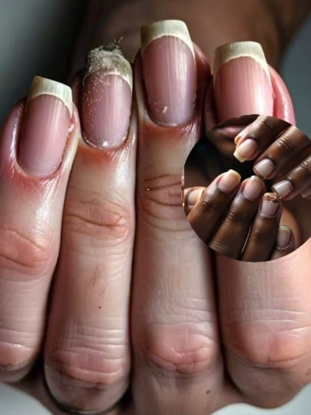 ये 4 फूड्स खाने से तेजी से टूटते हैं नाखून! चली जाती है उनकी चमक