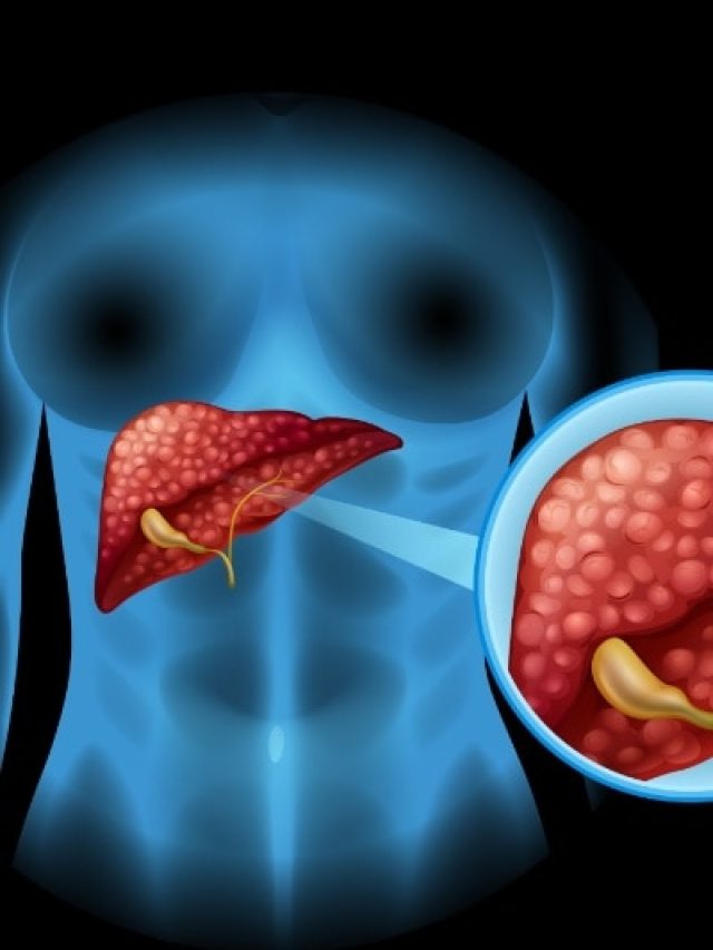 शरीर खराब करने से पहले ये 2 संकेत देता है फैटी लिवर, लक्षणों को जानकर तुरंत लें एक्शन